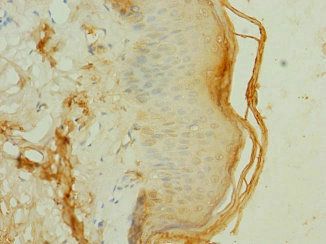 FRS3 Antibody
