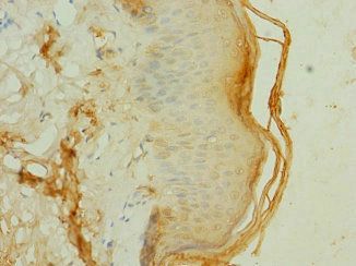 FRS3 antibody