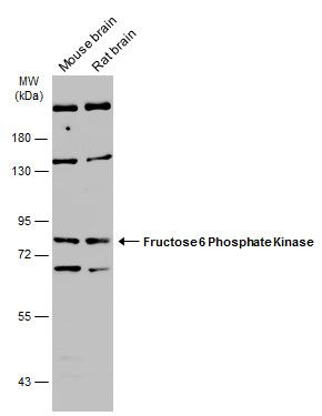 Fructose 6 Phosphate Kinase antibody
