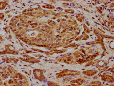FRYL Antibody