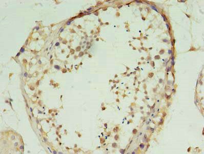 FSCB Antibody