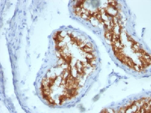 Fascin-1 (Reed-Sternberg Cell Marker) Antibody