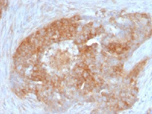 Fascin-1 (Reed-Sternberg Cell Marker) Antibody
