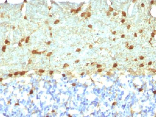 Fascin-1 (Reed-Sternberg Cell Marker) Antibody