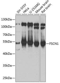 FSCN1 antibody