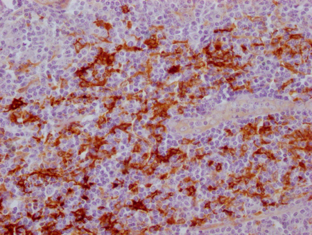 FSCN1 Antibody