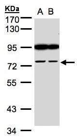 FSD2 antibody