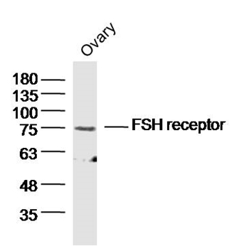 FSH Receptor antibody