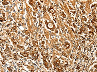 FSHR Antibody