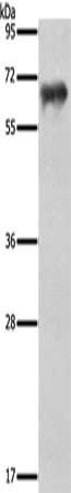 FSHR antibody