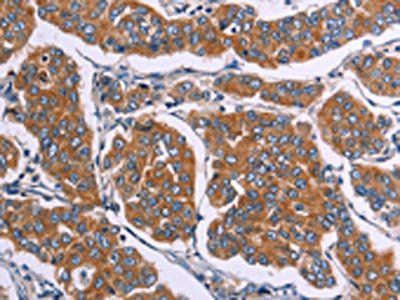 FST Antibody