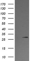 FTCD Antibody