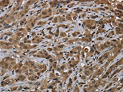 FTO Antibody