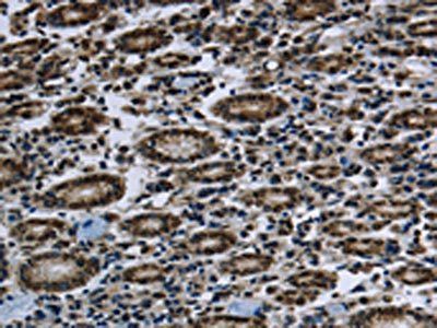 FTO Antibody
