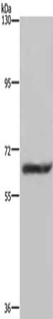 FTO Antibody