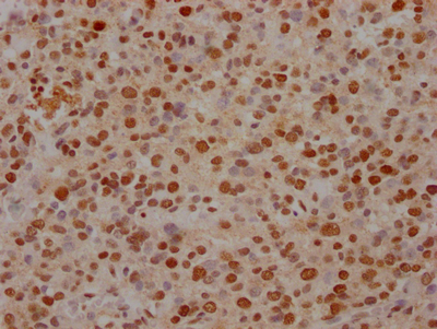 FUBP1 Recombinant Monoclonal Antibody