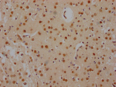 FUBP1 Recombinant Monoclonal Antibody