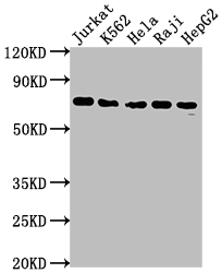 FUBP1 Recombinant Monoclonal Antibody