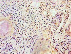FUBP3 Antibody