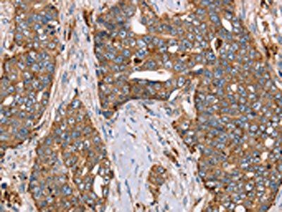 FUCA1 Antibody