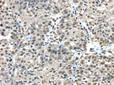 FUS Antibody