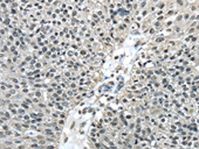 FUS Antibody
