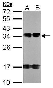 SDHB antibody