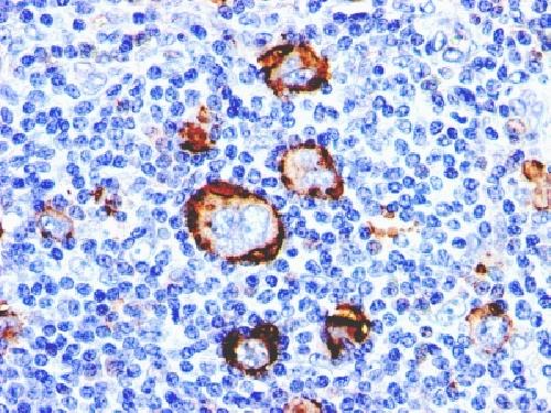 CD15 / FUT4 (Reed-Sternberg Cell Marker) Antibody