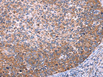 FUT8 Antibody