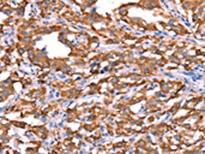 FXR1 antibody