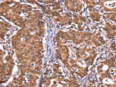 FXR1 Antibody
