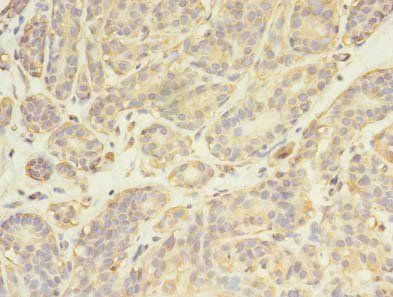 FYN Antibody