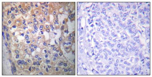 Fyn (Phospho-Tyr530) Antibody