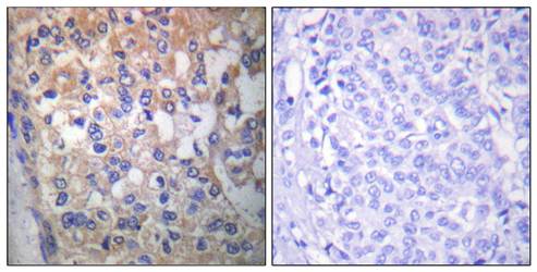 Fyn (phospho-Tyr530) antibody