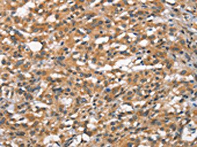 FZD1 Antibody