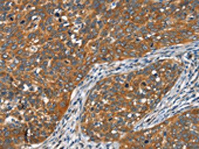 FZD1 Antibody