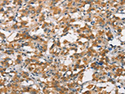 FZD1 Antibody