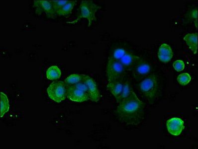 FZD1 Antibody