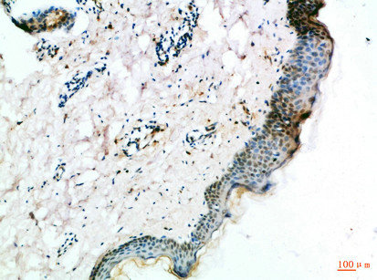 FZD4 Antibody