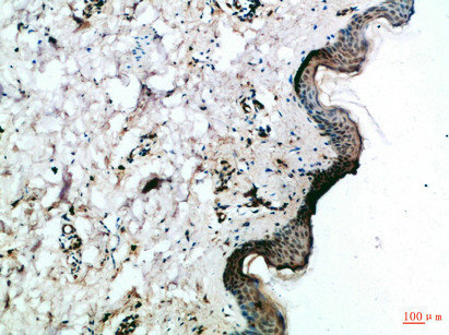 FZD4 Antibody