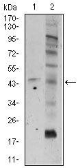 FZD5 Antibody