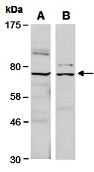 FZD8 (vPairTM) Antibodies
