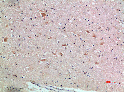 FZD9 Antibody