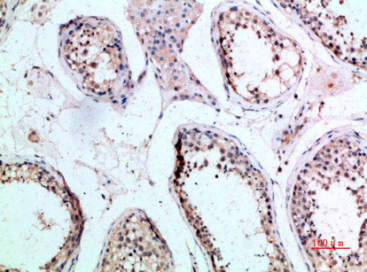 FZD9 Antibody