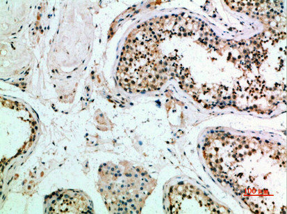 FZD9 Antibody