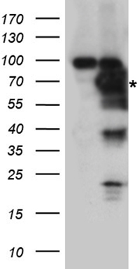 G CSF Antibody