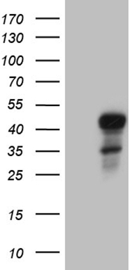 G CSF Antibody