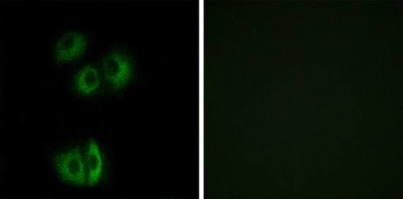 CELSR3 Antibody
