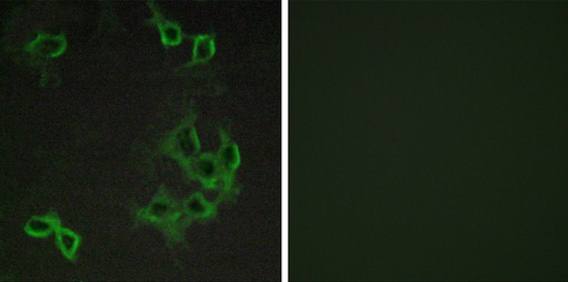 CCRL1 Antibody