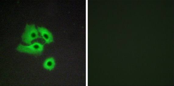 CCBP2 Antibody